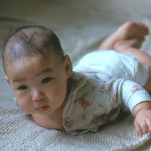 Zachary on his tummy in 1975