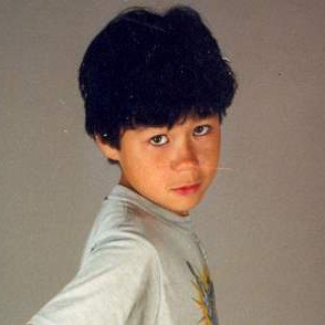 Simon showing his injury in 1988